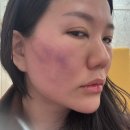 안산예쁨주의쁨의원 이미지