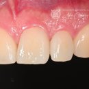 솔라움치과기공소 이미지