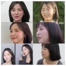 이노피부과의원 | 문래동피부과 탄력 올려주는 올타이트 리프팅