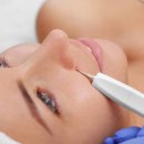 리엔뉴의원 | 점 빼고 나니 달라진 내 얼굴, 더 밝고 깔끔한 피부를 위한 첫걸음