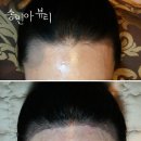 수정헤어라인 - 김해시 인제로169번길 10 | 수정헤어라인