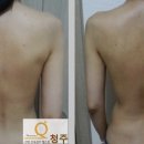 맘스퀸