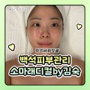 동안을 부르는 얼굴&두피관리 | 일산윤곽관리 백석피부관리 소마래디컬 by 김숙 윤곽관리 먹뜨바화장품 솔직후기