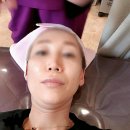 압구정미라클의원 | 압구정미라클의원에서 처음 받아본 울쎄라리프팅 효과 내돈내사