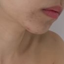 피브이 | 이대 피부관리 피브이 에스테틱 - 프라이빗 한 피부장벽관리 후기