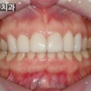 모치과기공소 이미지