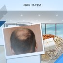 금광카클리닉 | 강남 삼성동 선릉역탈모전문 윤스탈모#두피관리#남아프리카공화국#자연환경