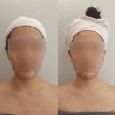코아미용，발관리샵 | [대구 미용] 경락, 얼굴 축소, 마사지, 찐 후기, 승모근 관리 추천_빛의전신