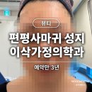 편평사마귀 성지 예약만 3년, 인천 이삭가정의학과 무제한 가격 공개