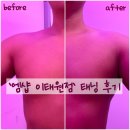 [이태원 남자왁싱, 태닝] 맨즈뷰티샵 엠샵 이태원점 태닝 후기