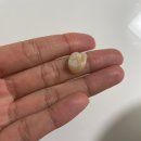 스마일블로썸치과의원 이미지