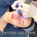 프로메디칼 | 순천 피부관리 왕지동 아름온에스테틱 셀프로샷 내돈내산 후기