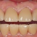 RPD치과기공소 이미지