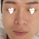 그린필스킨케어 네이버블로그