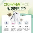 경아치과의원 네이버블로그