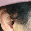 오티콘보청기 고양덕양점 이미지