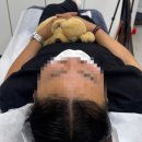 광명탈모 SMP 두피문신 닷센스신사 정수리커버 후기