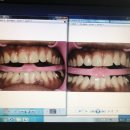 강서탑치과의원 이미지