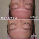 채움스킨&바디
