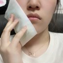 리라이브치과의원 | (발산)리라이브치과의원 사랑니 발치 리얼..후기