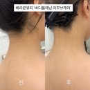 광주 신개념바디플래닝리무브케어 <베리윤뷰티> 뒤태미인 되기👰🏻‍♀️
