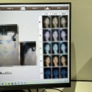 구산가든 | 압구정로데오피부과 하이퍼 티타늄리프팅 솔직후기 친구와 함께 방문한 이유