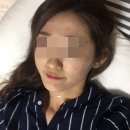 약초활용 생활건강법 | 얼굴 여드름 없애는법 피부과 치료 후기