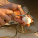 파킨슨병, 증상이 나타나기 수십년전에 알 수 있다면 이미지