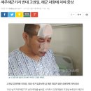 고권일 위원장님 교통사고로 중상 이미지