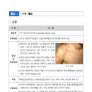 수두 감염예방 수칙 등 안내 이미지