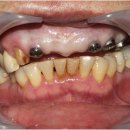 협진치과기공소 이미지