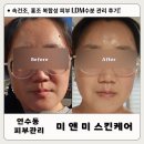 미앤미스킨케어 네이버블로그