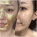 AN에스테틱 - 노원구 동일로 1003 | 구리피부관리 [ 제이 더 에스테틱 ] 속건조 잡는 24K 골드테라피 신부관리 여드름피부 추천!