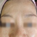 월곶노래연습장 | [정왕동피부관리] 24년차 베테랑 피부관리실 구은희에스테틱 시그니처 프로그램 &#34;피부지우개 관리&#34; 후기