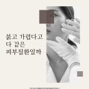 해운대역피부질환피부과, 피부 증상만 보고 스스로 판단하면 안 되는 이유