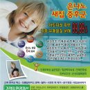 빌로채 이미지