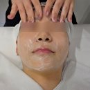 제네시스 | 선릉역피부과 기미 잡티 색소치료 레이저 토닝 효과 (제네시스 + 레블라이트) 내돈내산 후기