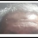 손바닥에 개덕교 십자가 손금과 맞박에 복숭아 주름은 뭘 말하는가? 2020년 4월 5일 6시 15분 업로드 날짜. 이미지