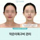 관상학 | 대구 피부관리, 관상학적 분석으로 내 이목구비 조화를 짚어준 고운빛깔에스테틱 대구점