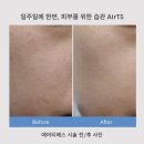 티에스 메디칼 이미지