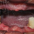 동행치과기공소 | 강남역임플란트치과 추천 후기 비교 분석