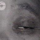 밀리미터(millimetre) 이미지