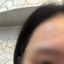 오라클피부과의원 | [서산 병원 후기] 서산 오라클 피부과 의원 후기(염증주사 가격 등)_내돈내산