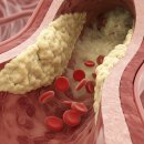(주)신장바이오 | 치매·중풍·심장병을 한 번에 막는 혈당 관리의 진짜 비밀 기능