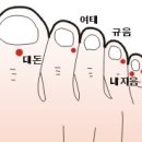 안면신경마비의 초기증상과 치료법 이미지