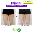 톡스미의원 이미지
