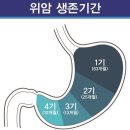 위암 원인과 사망률 1위인 이유 이미지