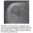 MRI : Bony Pelvis, Knee, Shoulder &amp; Elbow - 기초가 중요하다는 걸 보여주는 자료 이미지