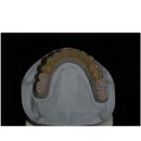 위드 치과기공소 이미지