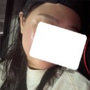 라라뷰티랜드제주 | [안산 물광피부관리 추천] 라라뷰티랜드안산에서 크레이지015받고 물광피부된 후기